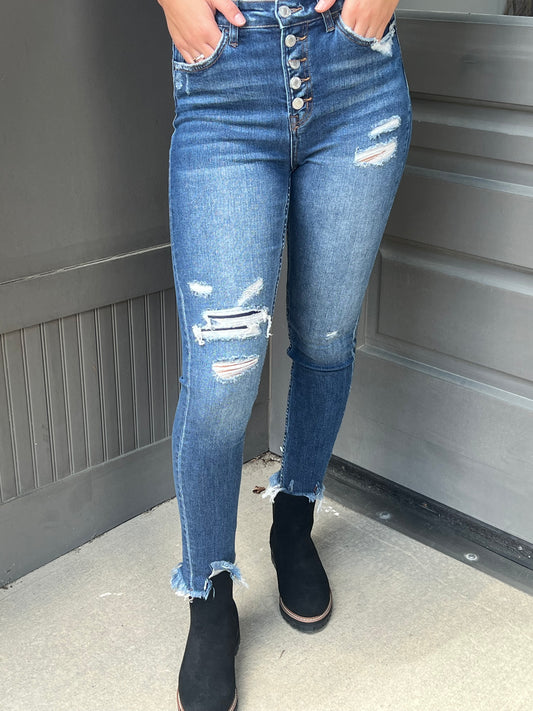 The Button Fly Distressed Haylie Jeans